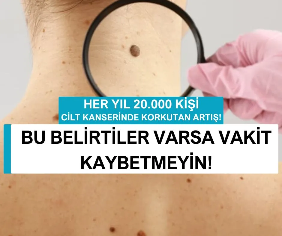 BU BELİRTİLER VARSA VAKİT KAYBETMEYİN!